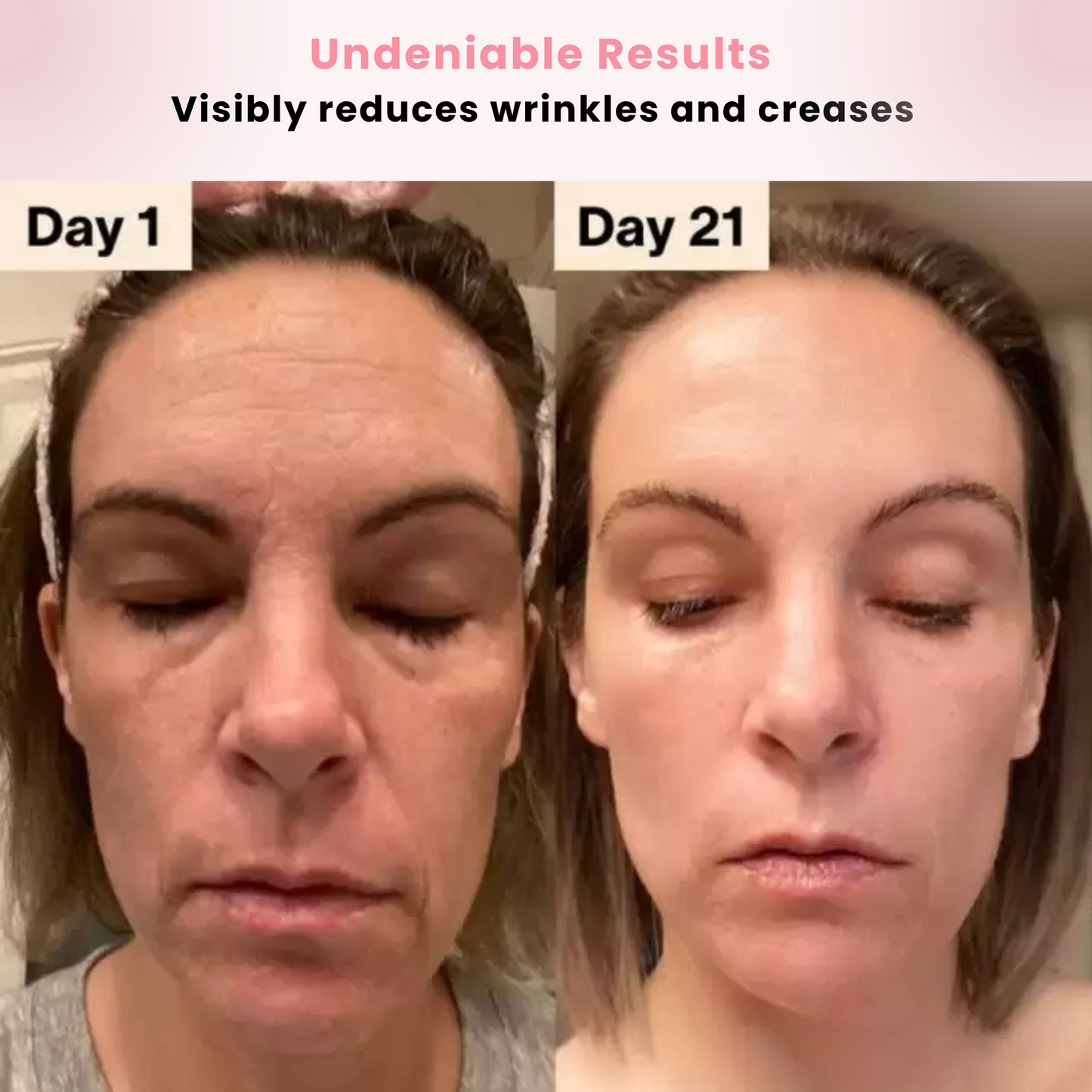 Revitalift | Red Light Beauty Wand