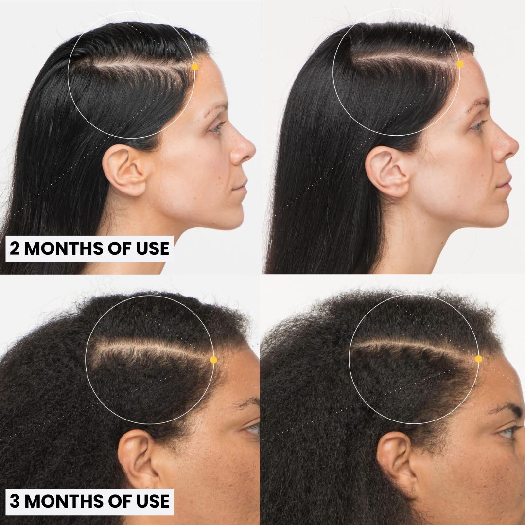 Pure Batana Oil #1 Authentic Hair Growth & Repair Oil from Honduras