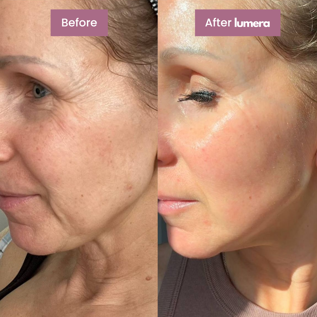 Calcium Multi Balm™