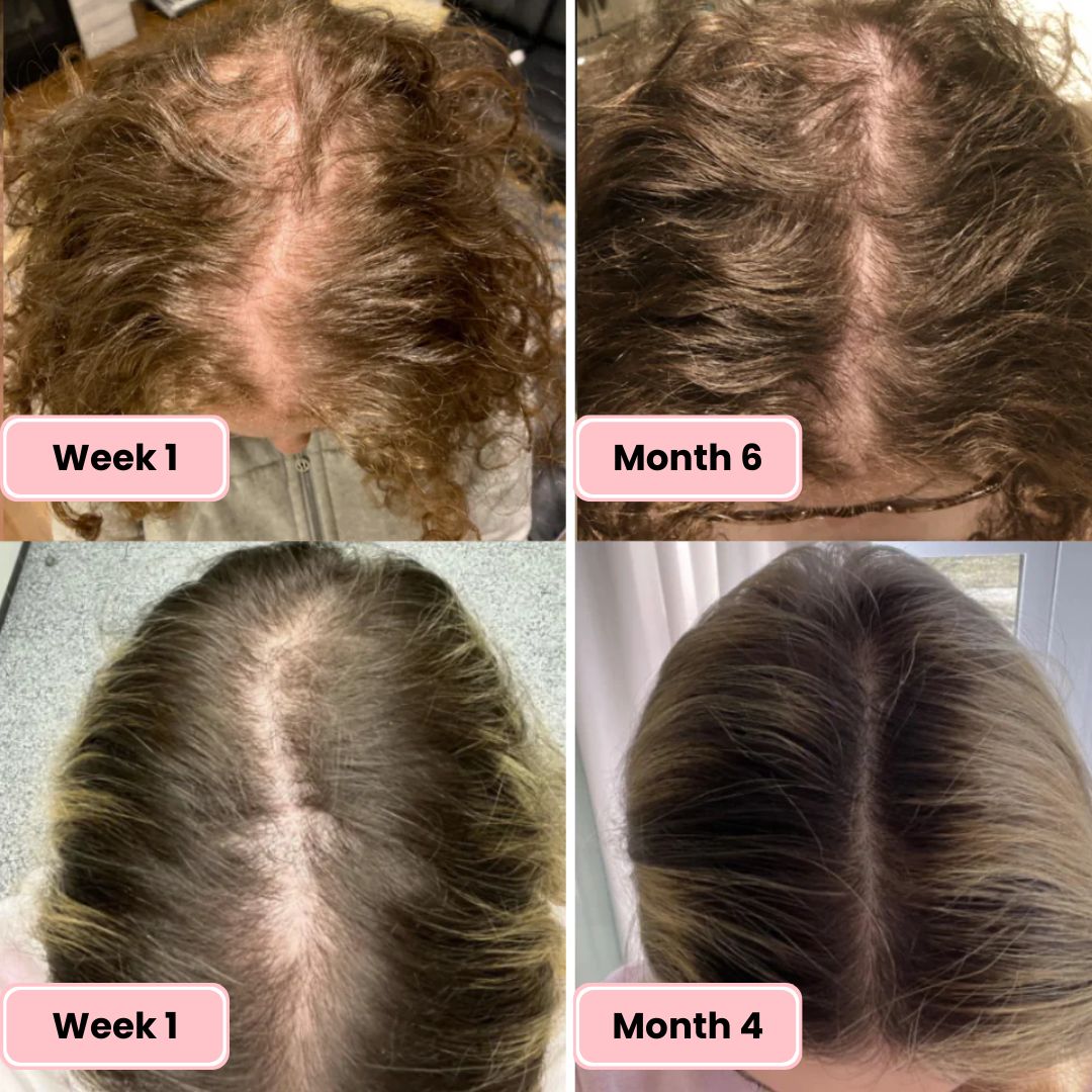 Lumera Hair Growth Oil for Thicker, Fuller Hair