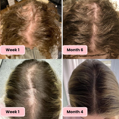 Lumera Hair Growth Oil for Thicker, Fuller Hair