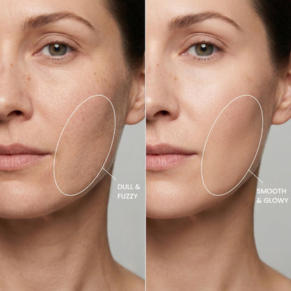 Lumera Sonic Dermaplaning Device
