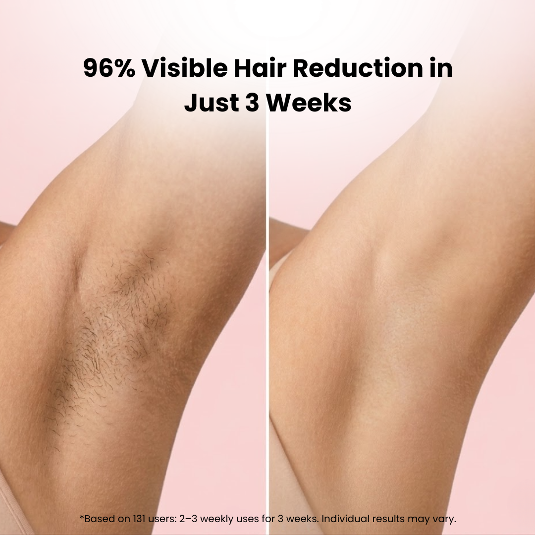 Lumera IPL Hair Removal Device