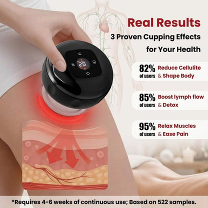 Lumera Smart Cupping Therapy Device