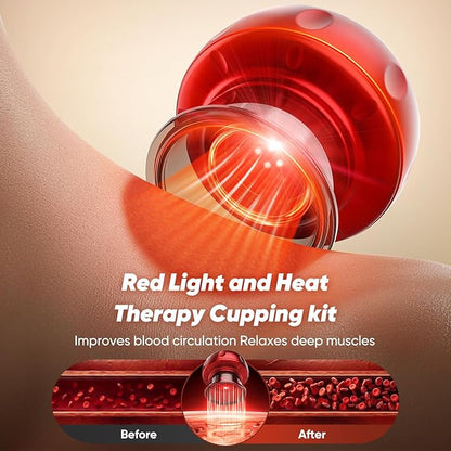 Lumera Smart Cupping Therapy Device