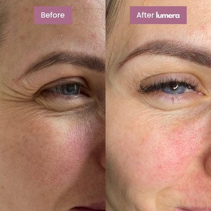 Calcium Multi Balm™